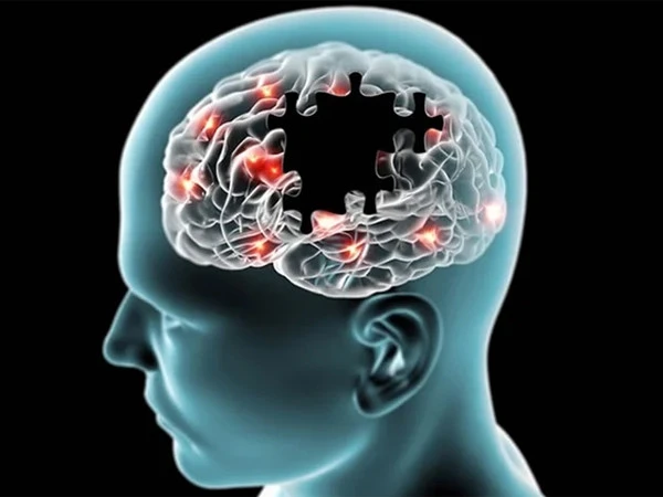 Major breakthrough against Alzheimer’s, new drug gives scientists hope